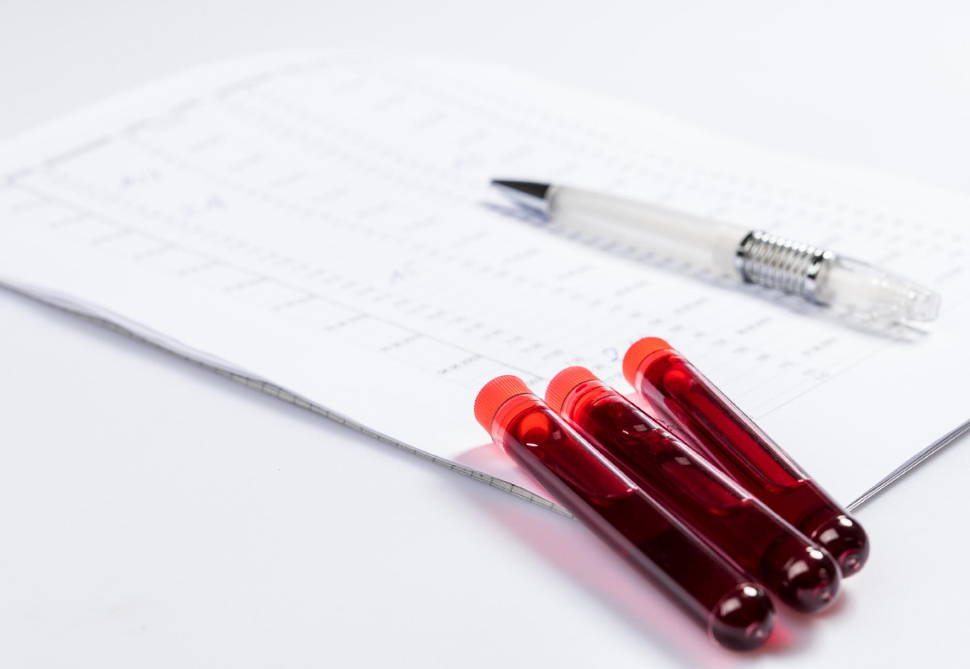 NHS set to trial ‘revolutionary’ sepsis blood test UK Healthcare News